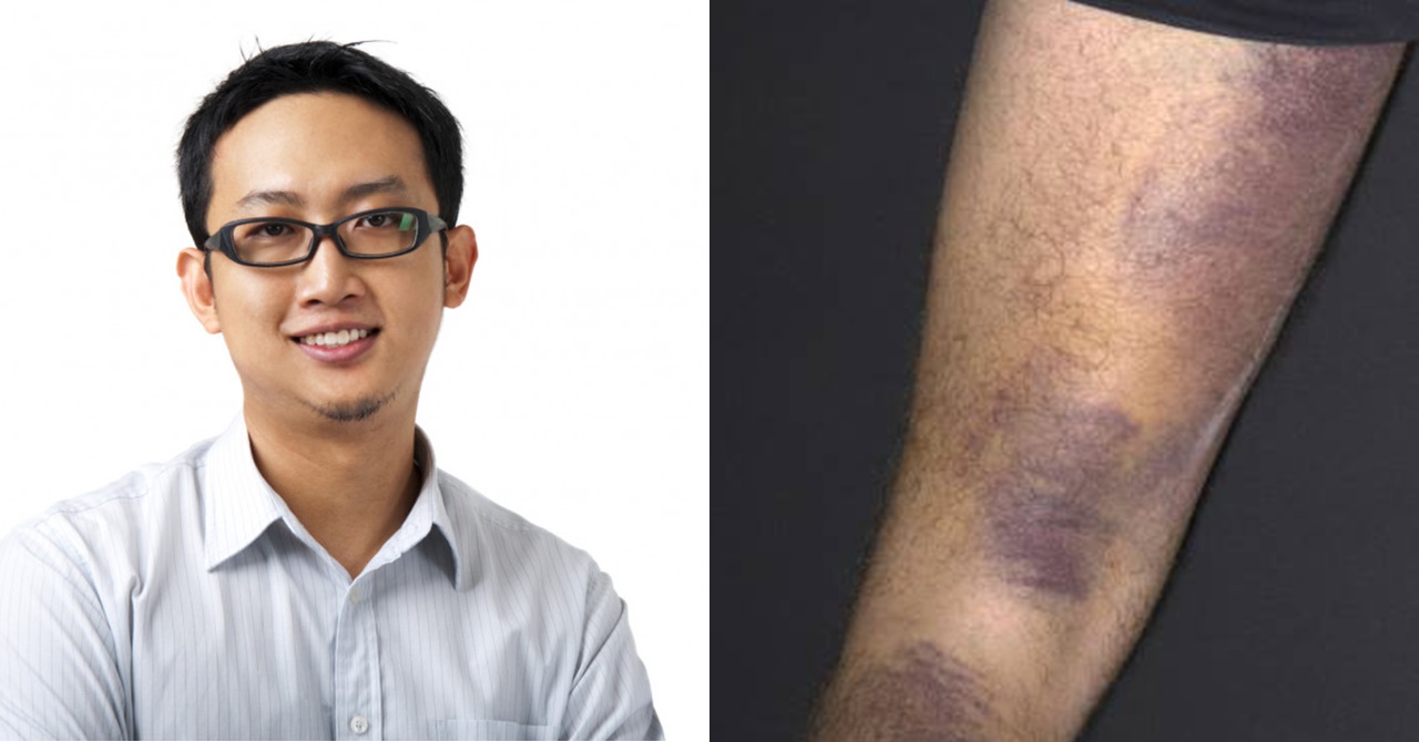Pinapalabas ng Binatang Ito na Inaalagaan Niya Maigi ang Ama, Kabaligtaran Pala ang Ginagawa Niya Rito