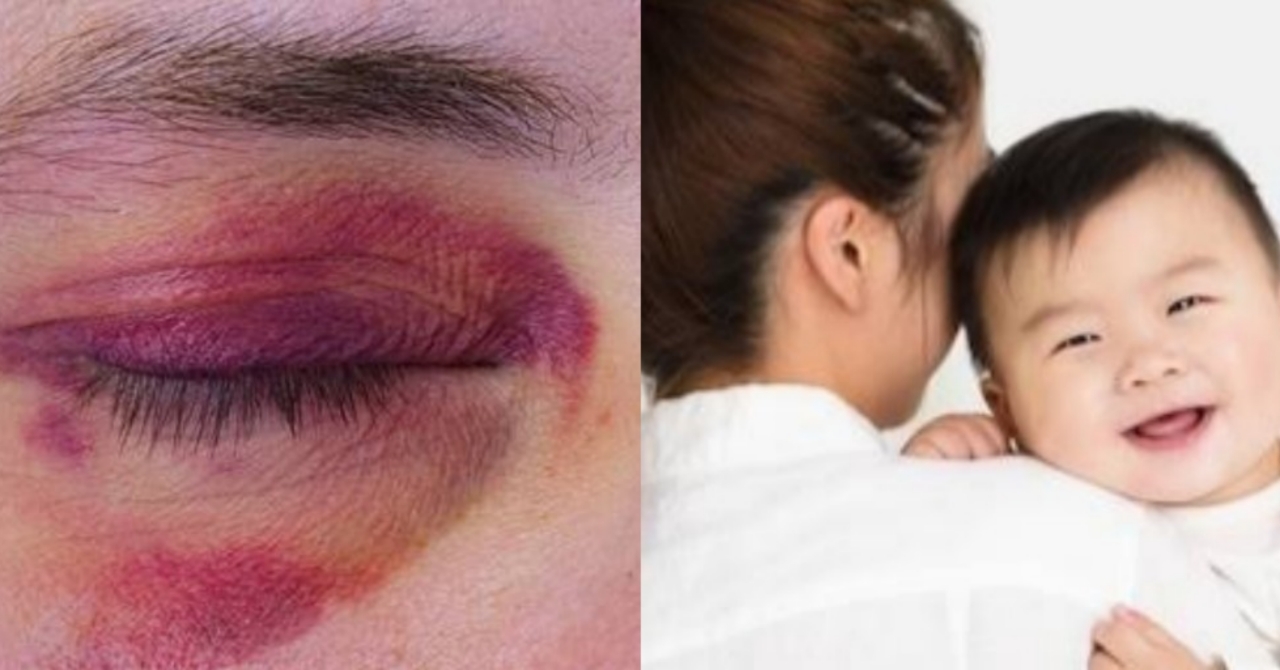 Nagalit ang Kaniyang Asawa at Napagbuhatan Siya ng Kamay; Iyon ay Dahil Lamang sa Limang Daang Piso