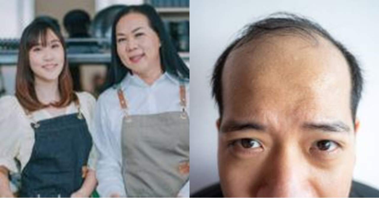 Walang Habas na Pinagtawanan ng Waitress ang Kustomer na Panot; Nang Muli Silang Magtagpo ay Wala na Siyang Mukhang Ihaharap